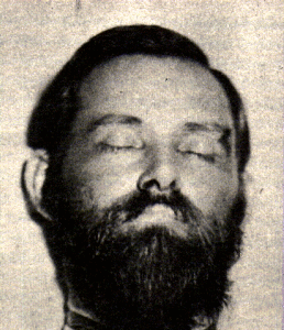 Alleged death photo of Jesse James